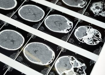 Il 5% dei tumori causati dalla Tac: lo studio dell’University of California che accende l’allerta