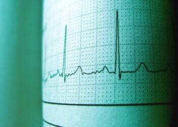 +++ Napoli trema ancora: nuova scossa di terremoto registrata, ma la causa non è di natura geologica. L’epicentro spiega tutto