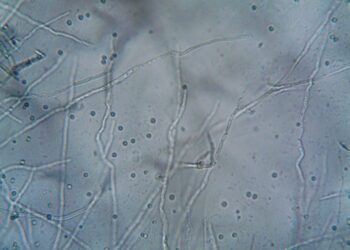 Tacchino ritirato da supermercati Pam: rischio Listeria