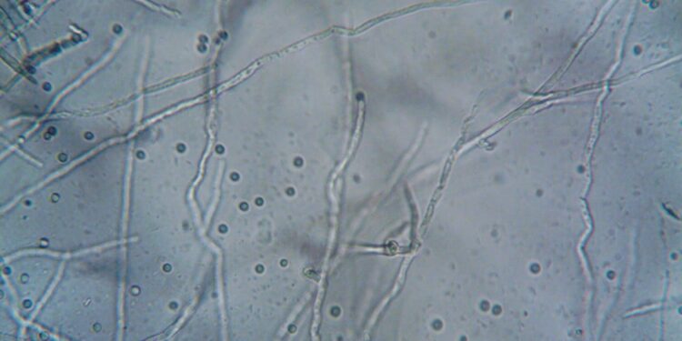 Tacchino ritirato da supermercati Pam: rischio Listeria